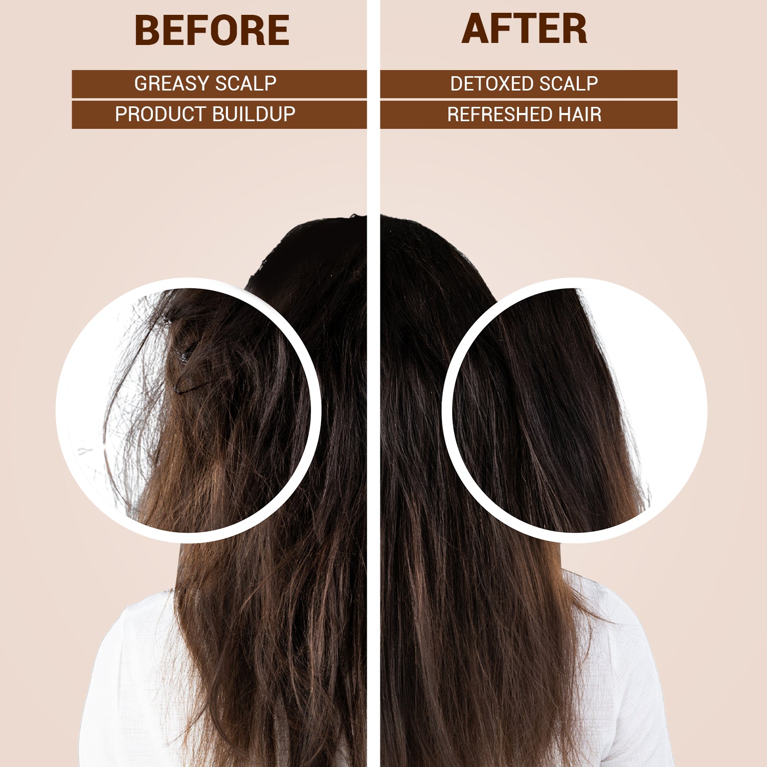 Detox &amp; Refresh Shampoo | Infused with Avocado &amp; Tea Tree Oil | Purifies Scalp &amp; Controls Oil | For Chemically Damaged Hair | Sulfate-Free, Paraben-Free | 250ml