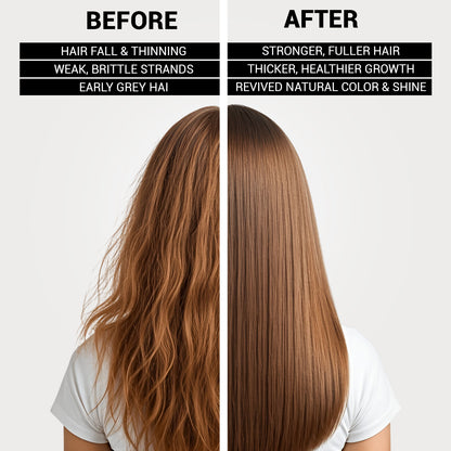 The Fit Hair Serum | Infused with Black Nigelle Seeds to Restore Hair Health &amp; Promote Hair Growth | Sulfate-Free, Paraben-Free | 50ml